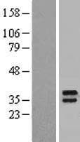 LY6K Protein (Over-Expression Lysate Myc-DDK (Flag))