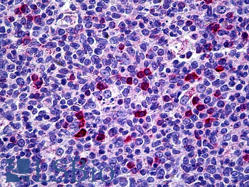 IHC-plus™ CIITA Antibody
