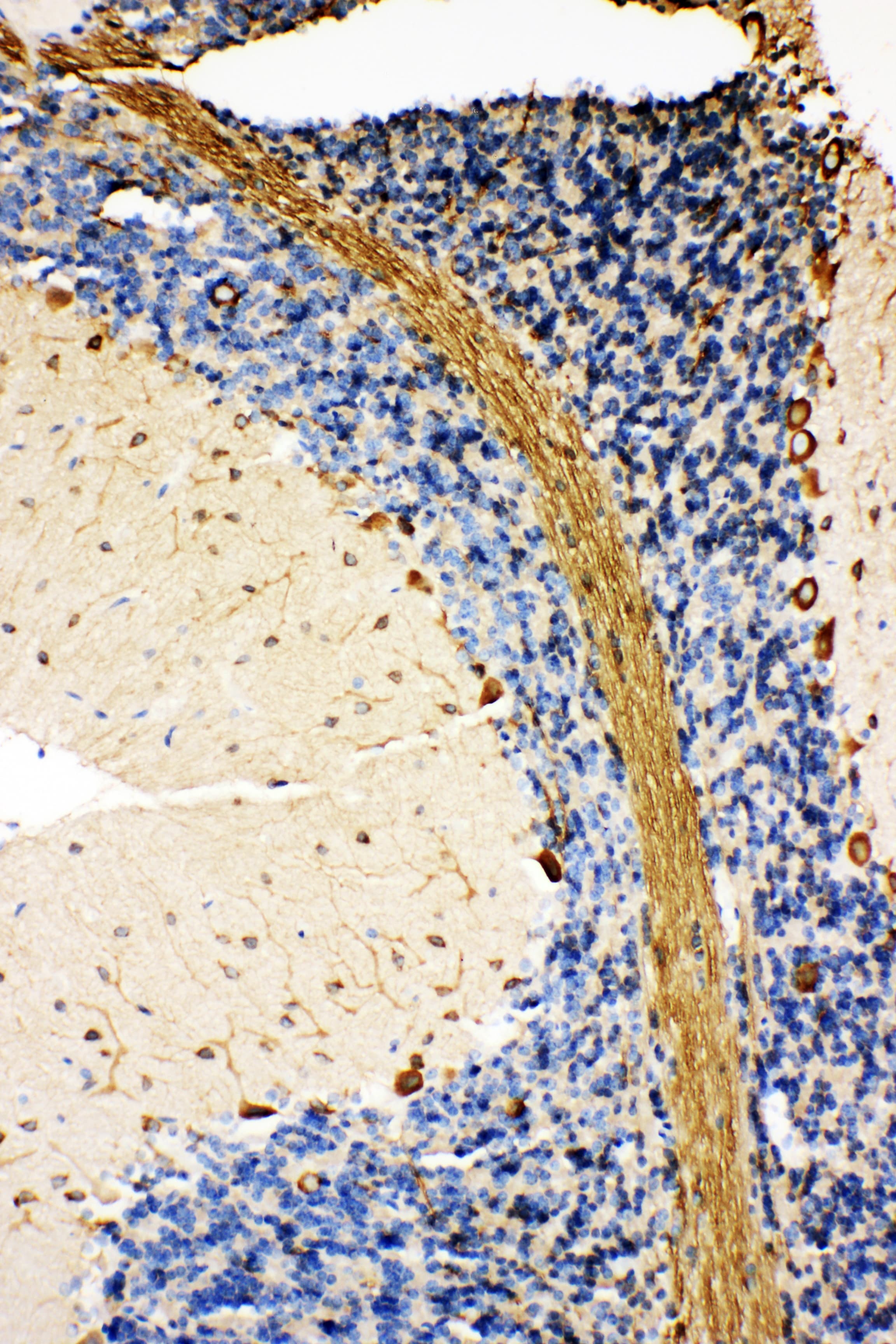 HSPA5 / GRP78 / BiP Antibody (aa603-617)