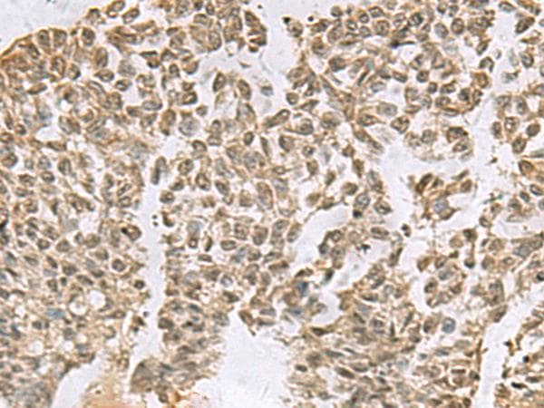 TCEB1 / Elongin C Antibody