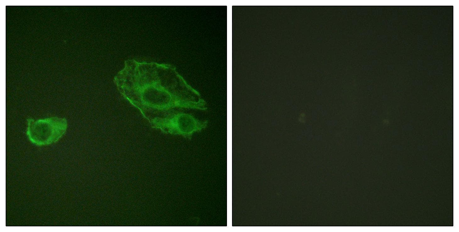 Polyclonal Rabbit anti-Human ERBB3 / HER3 Antibody (p1289, IHC, IF, WB)