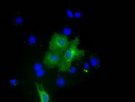 Monoclonal Mouse anti-Human PKLR Antibody (clone OTI1H9, IF, WB)