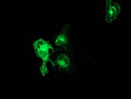 PRKCE / PKC-Epsilon Antibody (clone OTI1B4)