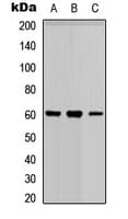PARP3 Antibody (N-Terminus)