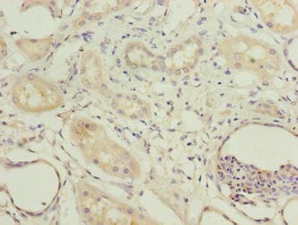 Polyclonal Rabbit anti-Human COBLL1 Antibody (IHC)