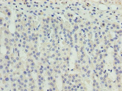 ZNF215 Antibody