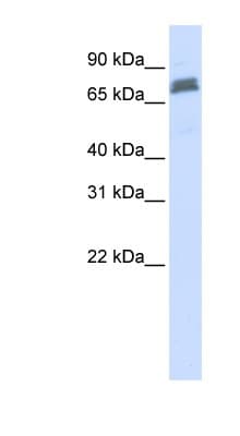 Polyclonal Rabbit anti-Human TRIM45 Antibody (aa36-85, WB)
