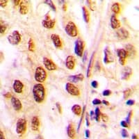 Polyclonal Rabbit anti-Human HDAC2 Antibody (C-Terminus, IHC, WB)