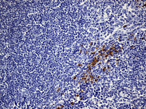 NCAM / CD56 Antibody (aa20-718, clone UMAB83, Carrier-free)