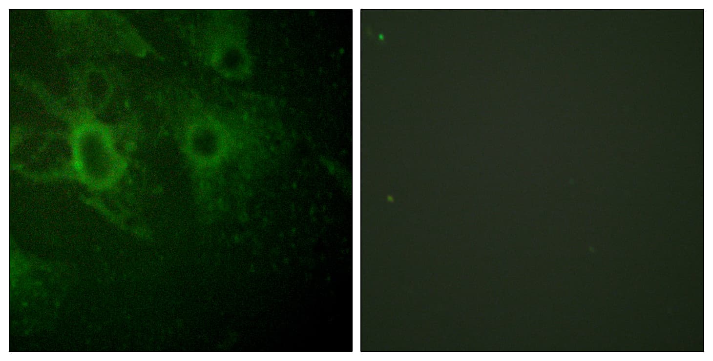 HCK Antibody (phospho-Tyr410)