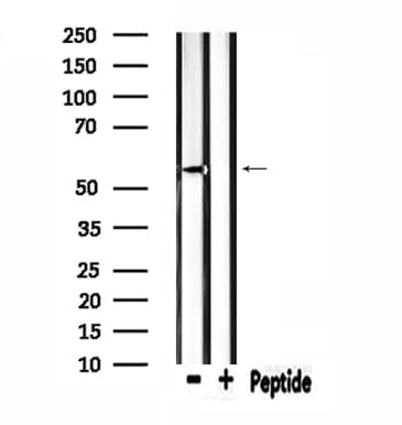 Polyclonal Rabbit anti-Human ZSCAN22 Antibody (IHC, IF, WB)