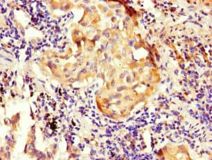 Polyclonal Rabbit anti-Human NOXA1 Antibody (IHC, IF, WB)