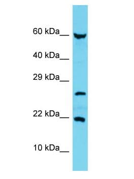 Polyclonal Rabbit anti-Human C17orf102 Antibody (aa59-108, WB)