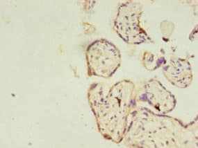 Polyclonal Rabbit anti-Human RERG Antibody (aa1-199, IHC, WB)