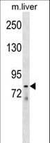 LOXL4 / LOXC Antibody (aa575-603)