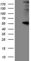 LOX / Lysyl Oxidase Antibody (clone OTI10D11)
