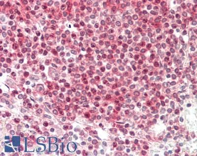 IHC-plus™ CD79A / CD79 Alpha Antibody (sequence AA 200+ of human CD79a protein, clone SP18)