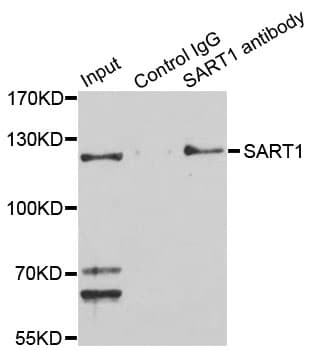 Polyclonal Rabbit anti-Human SART1 Antibody (WB)