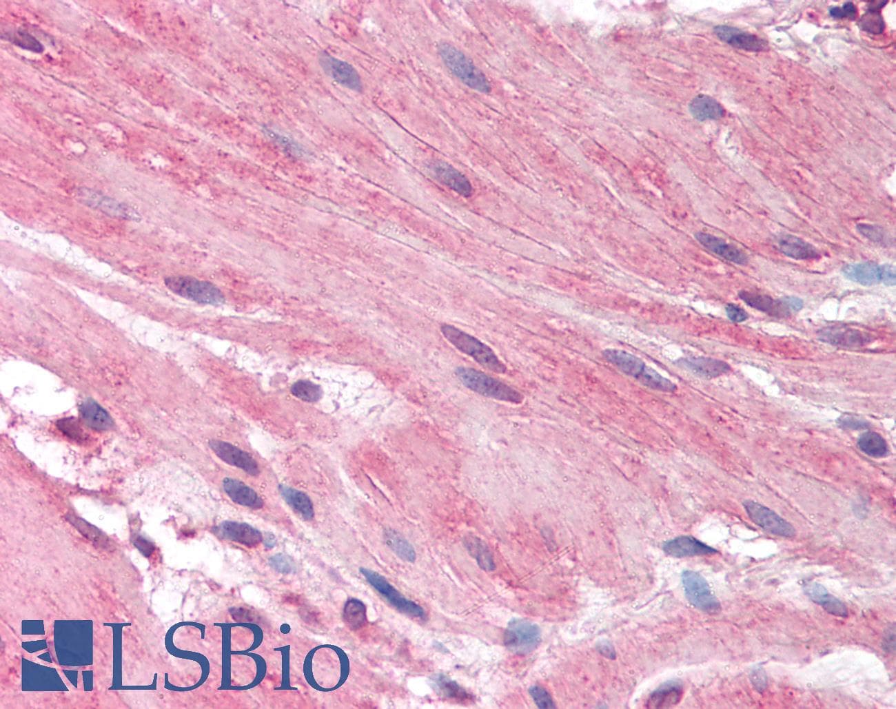 IHC-plus™ Polyclonal Goat anti-Human HRH1 / Histamine H1 Receptor Antibody (aa471-484, IHC, IF)