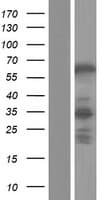 ABLIM2 Protein (Over-Expression Lysate Myc-DDK (Flag))