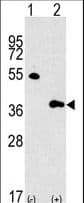 MLST8 / GBL Antibody (aa140-170)