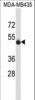 SPN / CD43 Antibody (aa32-60)