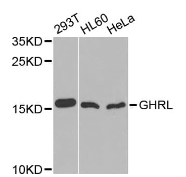 Polyclonal Rabbit anti-Human Ghrelin Antibody (WB)
