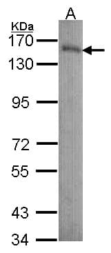 IHC-plus™ LAMB3 / Laminin Beta 3 Antibody (aa644-960)