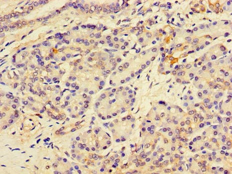 IHC-plus™ Polyclonal Rabbit anti-Human MBOAT5 / C3F Antibody (IHC)