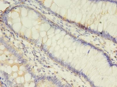 Polyclonal Rabbit anti-Human ALOX5 / 5-LOX Antibody (IHC)