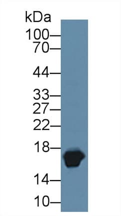 MB / Myoglobin Antibody (aa1-154, APC)