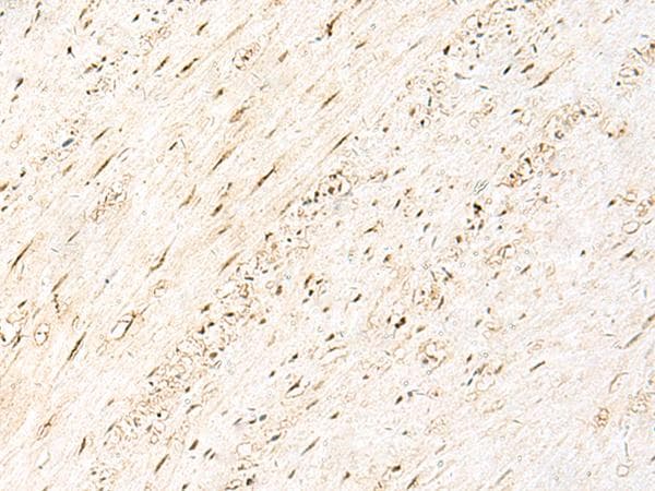 PRPF3 Antibody