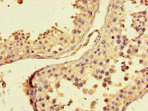 Polyclonal Rabbit anti-Human ZRSR1 Antibody (IHC)