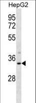 M-PST / STM Antibody (aa67-95)