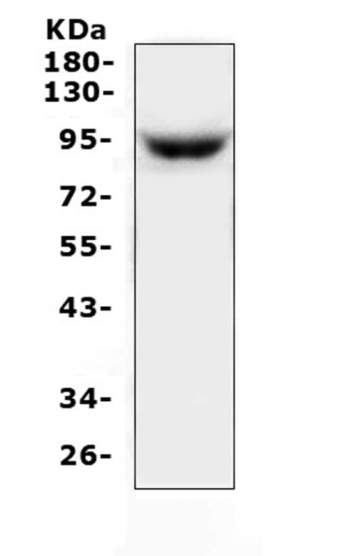 Polyclonal Rabbit anti-Human ZAK / MLTK Antibody (WB)