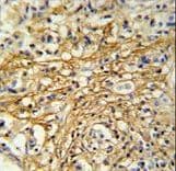CMC2 / C16orf61 Antibody (aa1-30)