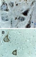 CASP9 / Caspase 9 Antibody