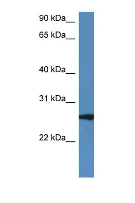 RAB27B Antibody (aa122-171)