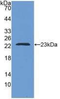 Human APRT Protein (Recombinant His, N-Terminal)