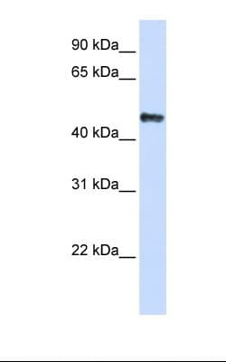 Polyclonal Rabbit anti-Human YBX3 / CSDA Antibody (aa290-339, IHC, WB)