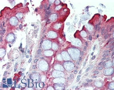 IHC-plus™ IFNAR1 / IFNAR Antibody (aa350-400)