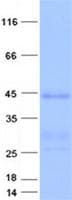 Human TMEM9 Protein (Recombinant GST, N-terminus + His, C-terminus)
