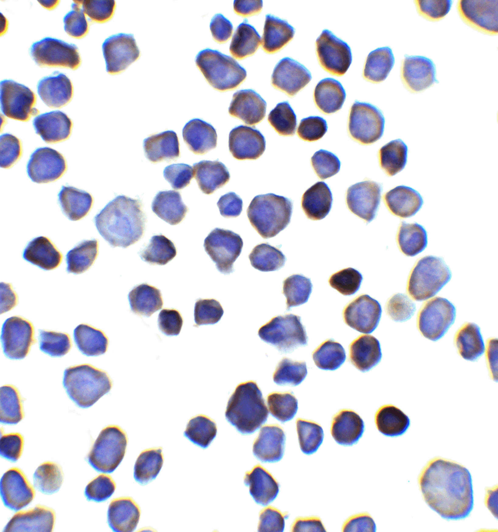 IHC-plus™ Polyclonal Rabbit anti-Human INPP4B Antibody (IHC, WB)
