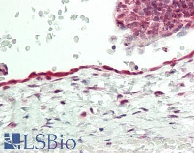 IHC-plus™ Polyclonal Rabbit anti-Human CHEMR23 / CMKLR1 Antibody (Internal, IHC, WB)