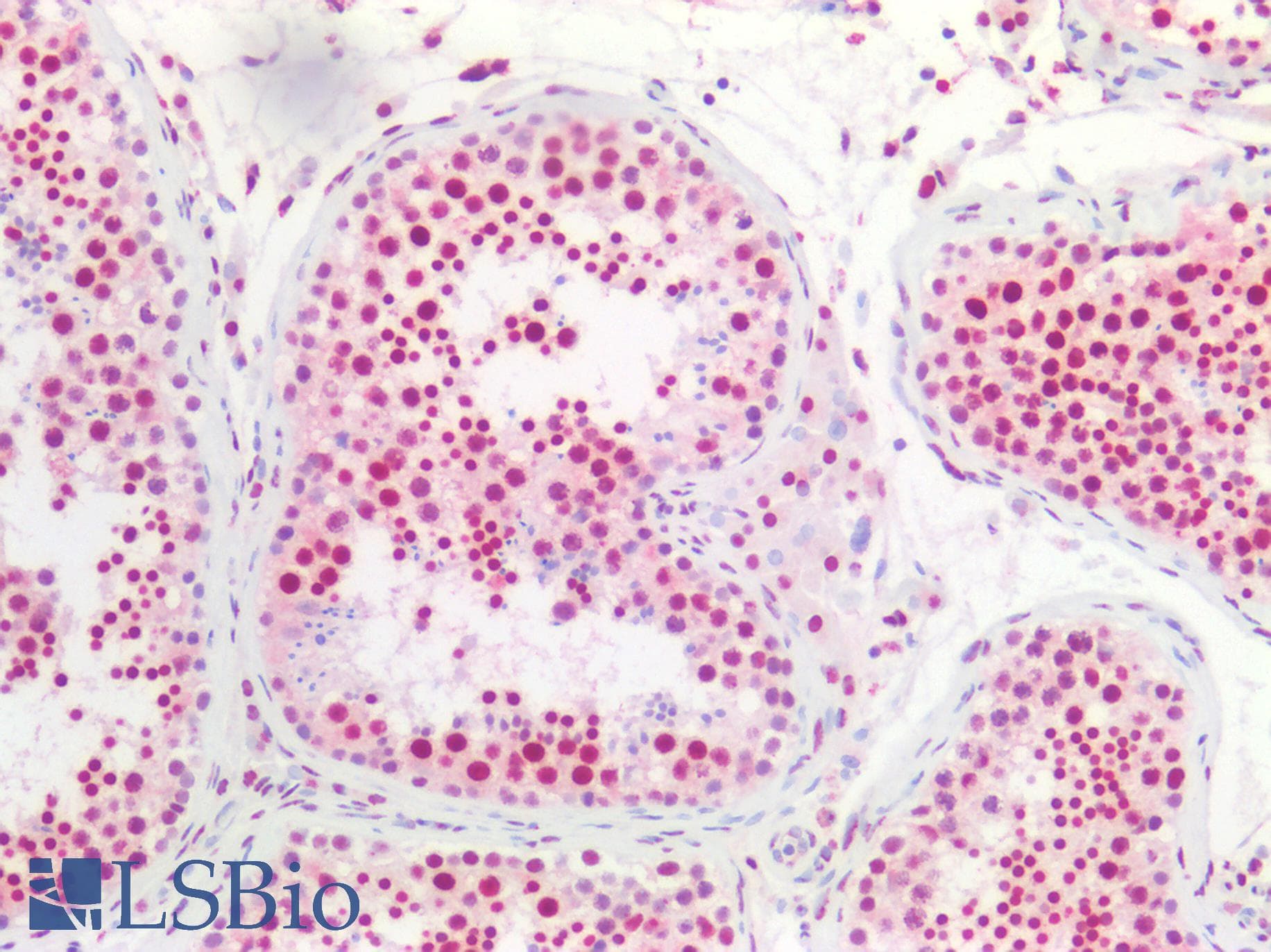 PathPlus™ NPM1 / NPM / Nucleophosmin Antibody (clone AT23F1)