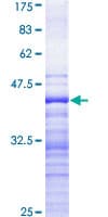 Human STK9 / CDKL5 Protein (Recombinant GST, N-terminus)
