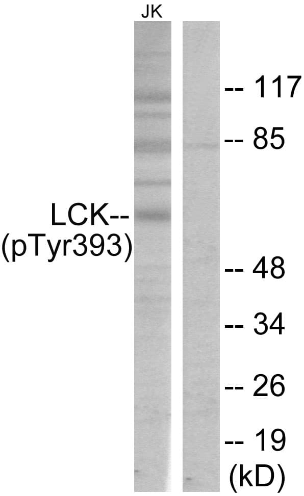 p56lck / LCK Antibody (phospho-Tyr393)
