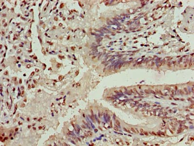HIST1H3A Antibody
