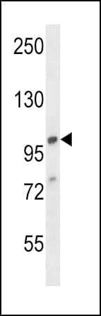 Polyclonal Rabbit anti-Human AP2A1 / AP2-Alpha Antibody (aa706-735, IHC, WB)