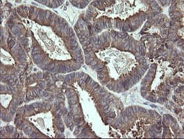 PDIA3 / ERp57 Antibody (clone OTI3E1)
